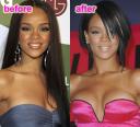 [Rihanna Fenty - przed i po powiekszeniu piersi[1].jpg]